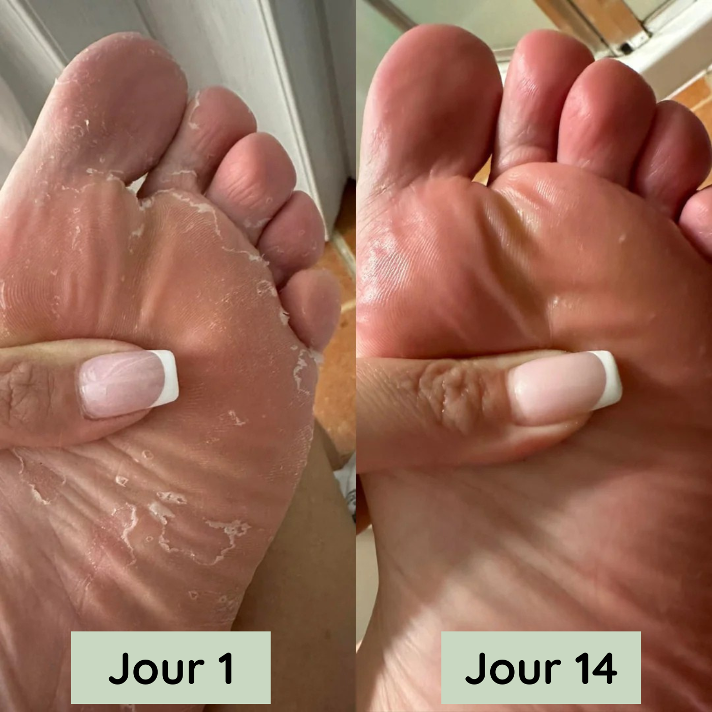 Comparaison des résultats Verdara entre le jour 1 et le jour 14